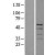 Western Blot: Cytokeratin 7 Lysate [NBL1-12396] - Western Blot experiments. 
Left-Control; Right -Over-expression Lysate for KRT7